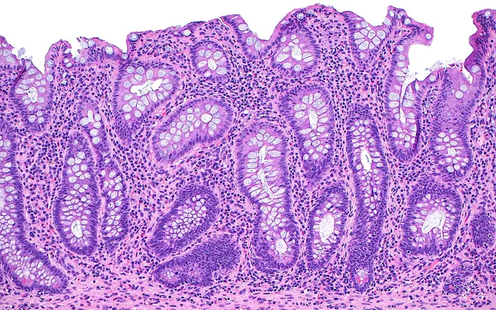 cAMPfield lands $180M to build gut disease drug