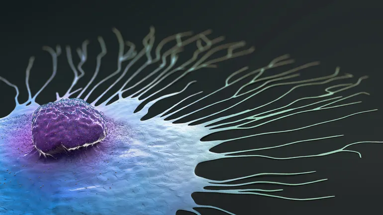 Celcuity breast cancer drug misses 'lofty' expectations in ASCO-spotlighted trial