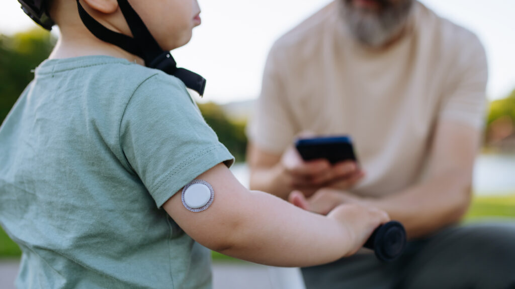Dexcom’s OTC CGM raises pediatric, public health questions