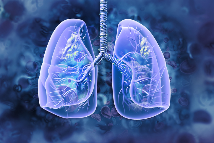 Guardant Health nabs FDA test approval to find patients for Boehringer's new cancer drug