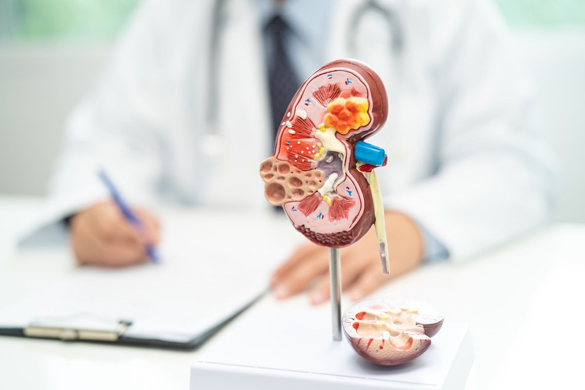 Medicare ACO rollout puts kidney care policy back on the watch list