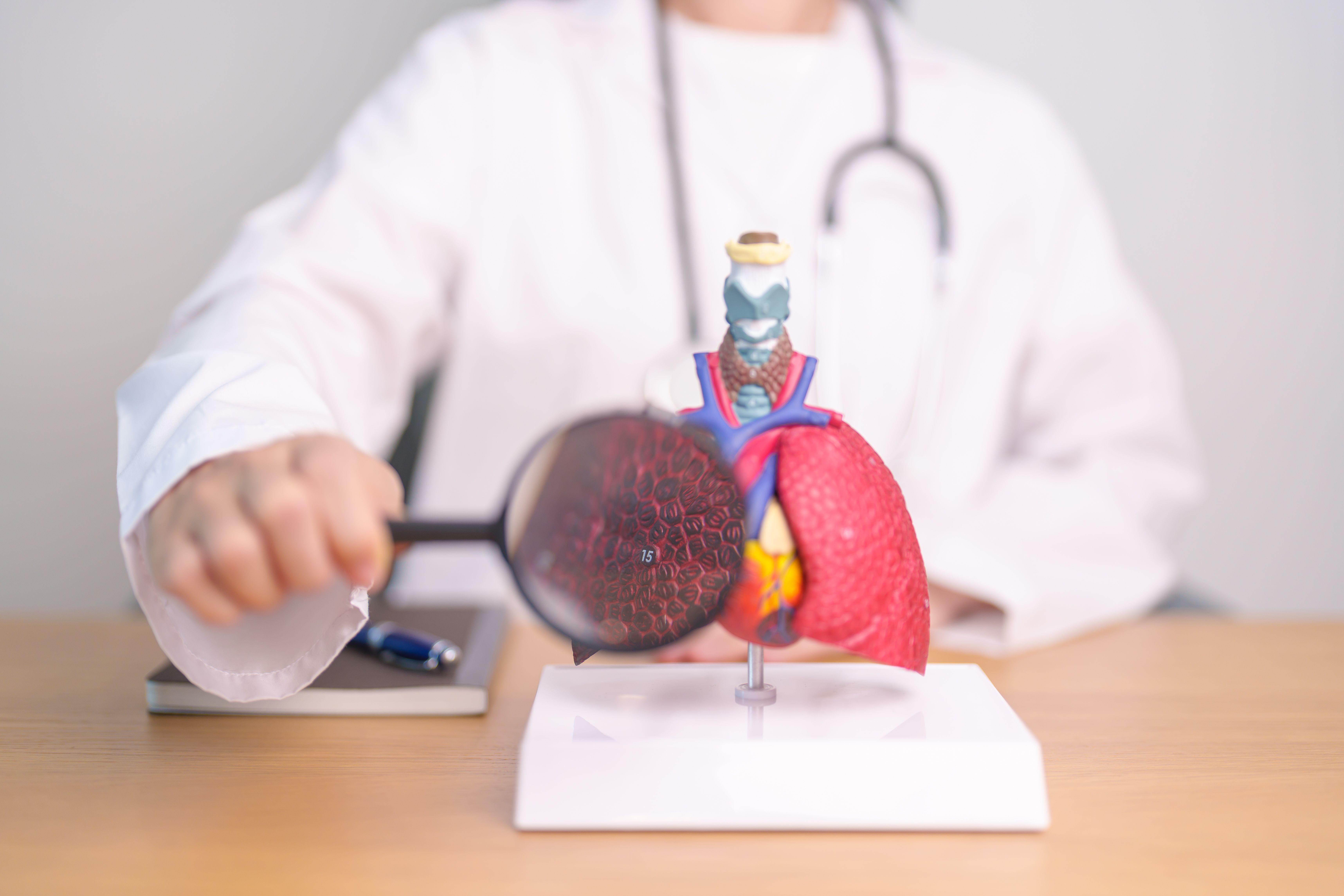 Non-CF bronchiectasis gets a Medicare cost spotlight
