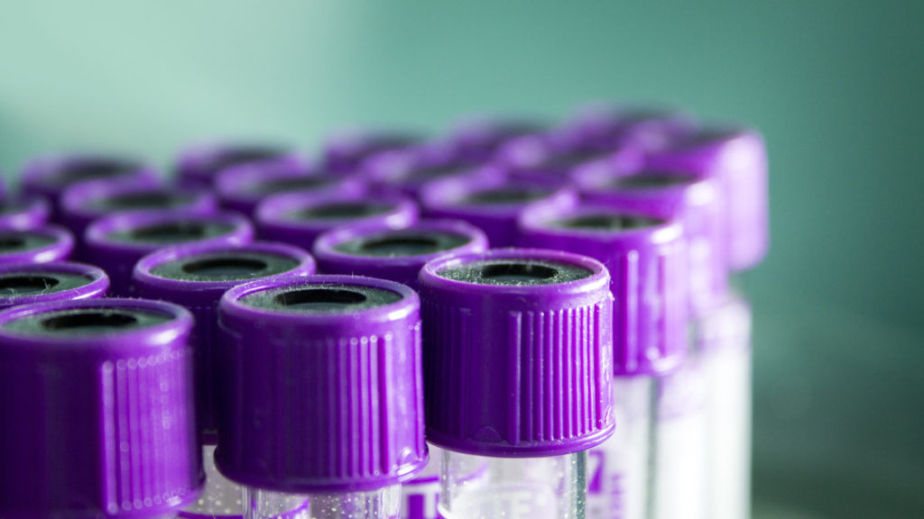 Opinion: Beware the unintended consequences of testosterone screening for military servicemembers