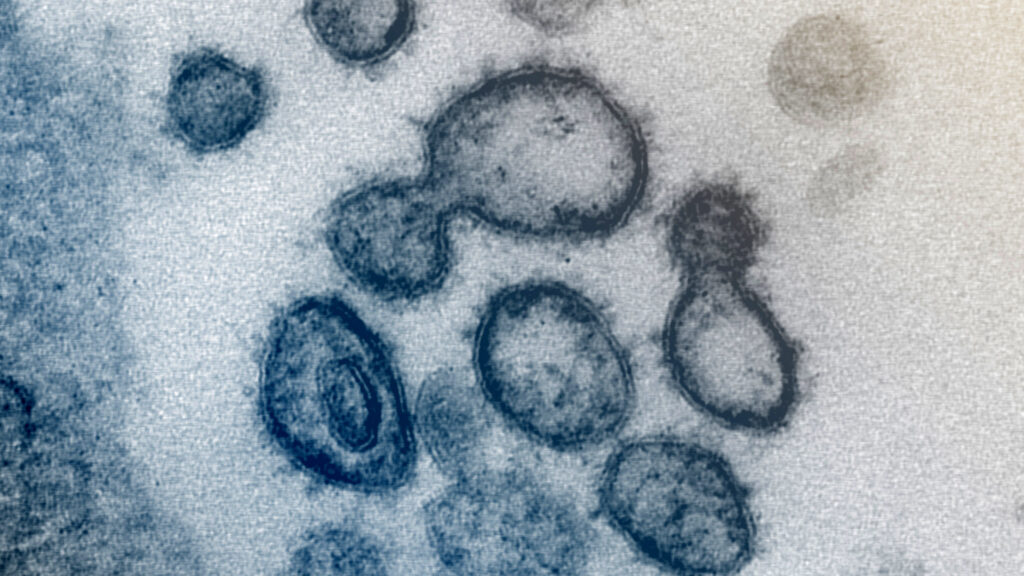 Opinion: How long Covid's scientific stalemate made it politically erasable