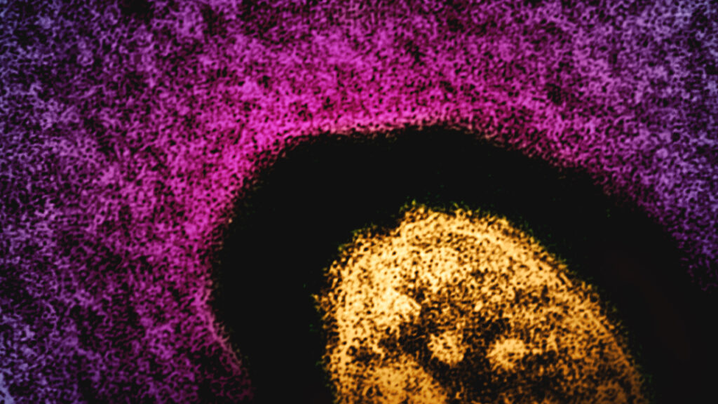 Opinion: Make infectious disease data boring again