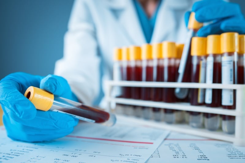 Qiagen launches latest diagnostic for bloodstream infections