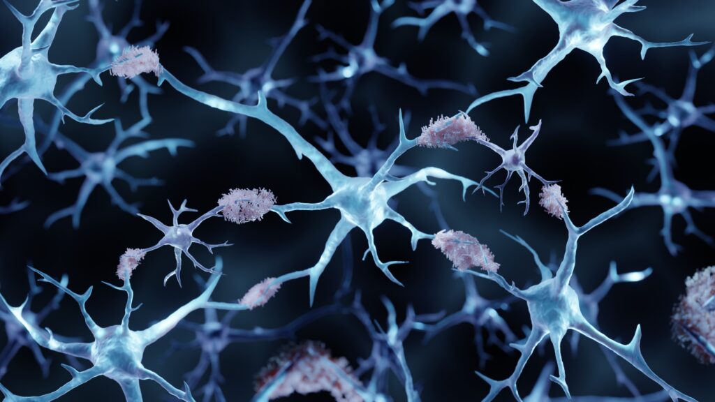 STAT+: Preliminary trial results suggest a path to a safer Alzheimer's treatment