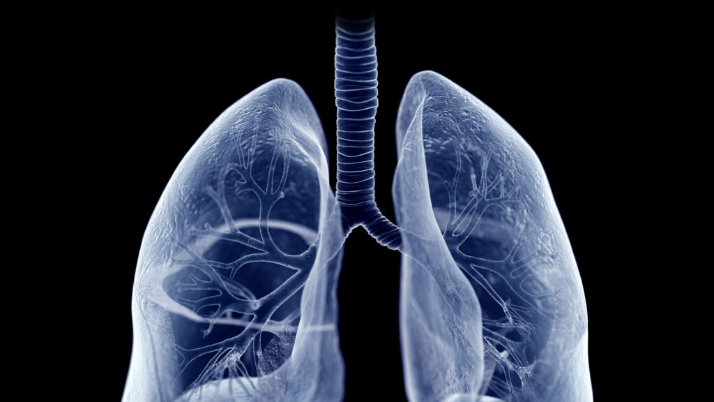 STAT+: Roivant lung disease drug hits mid-stage study goals