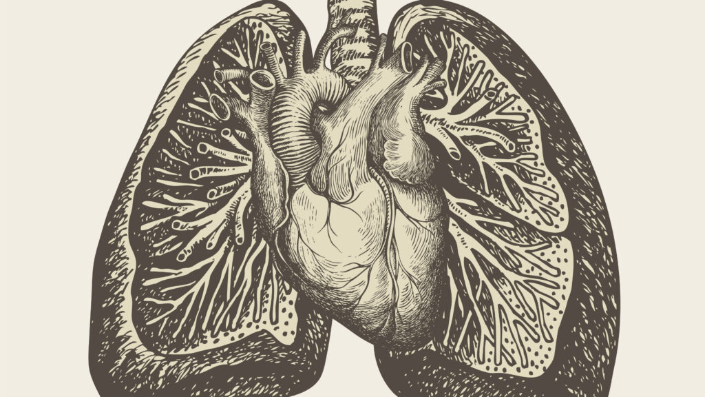 What is pulmonary hypertension and why would a new GLP-1 help?